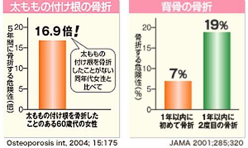 太ももの付け根・背骨の骨折リスク 太ももの付け根・背骨の骨折リスク